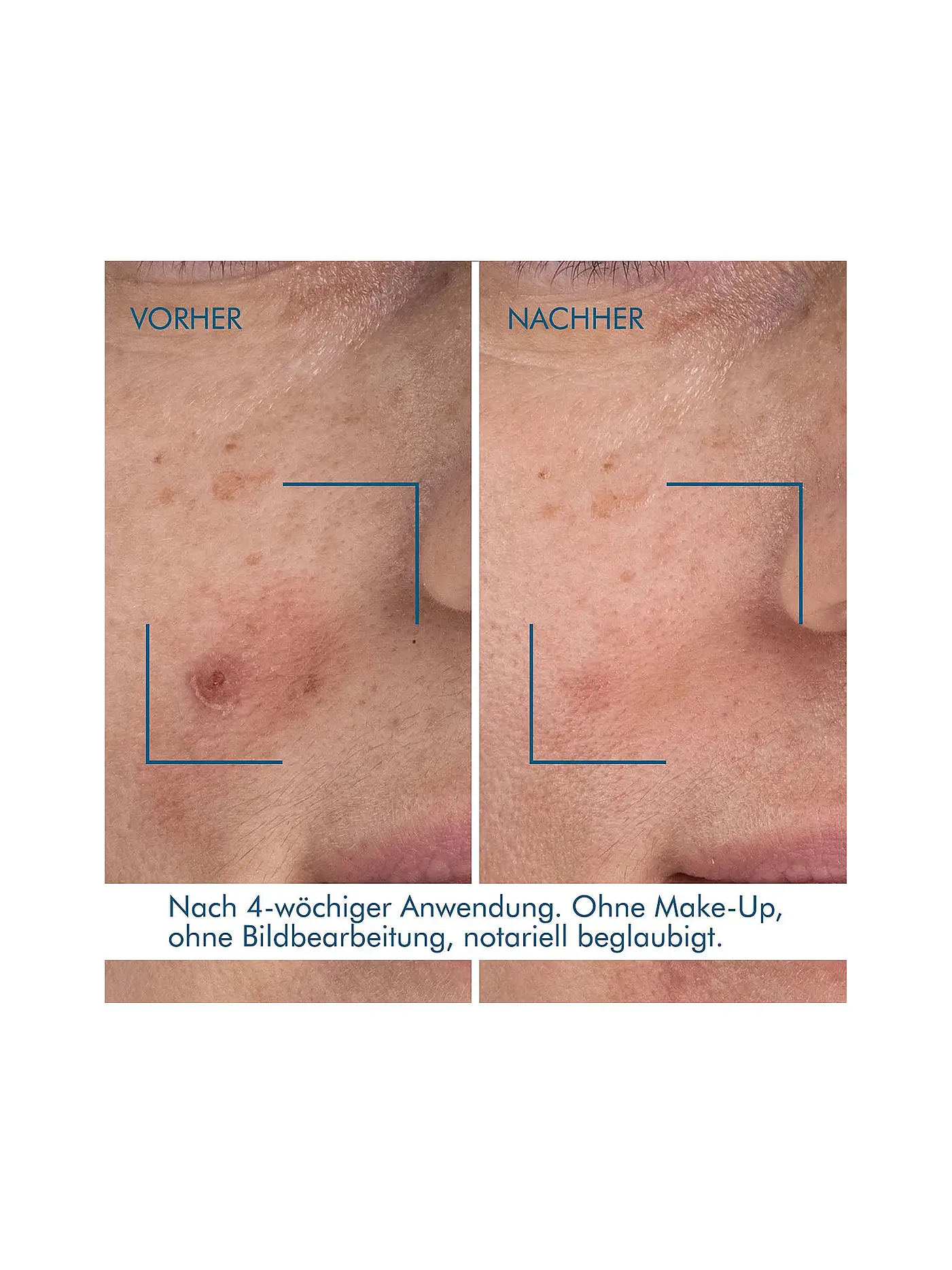BIOTHERM | Blue Retinol Resurface + Repair Night Serum 30ml | keine Farbe